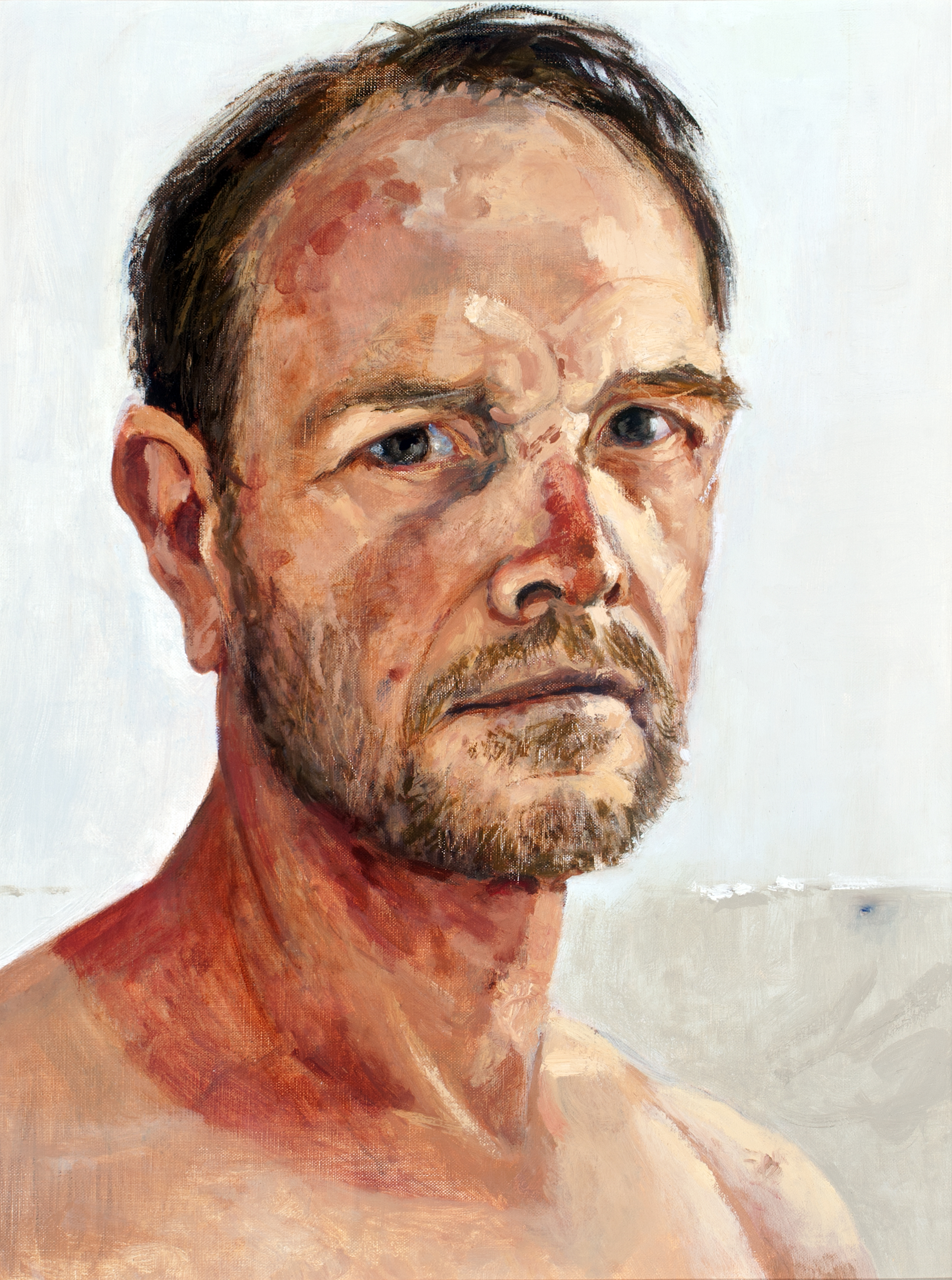 Self-portrait with sun damage 2014 Sayers